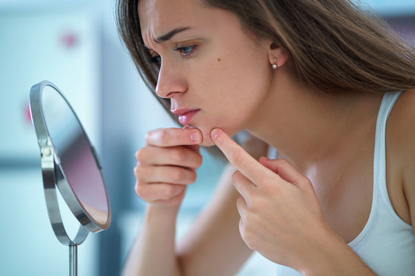 image-of-woman-with-acne-squeezing-pimple-in-mirror-meadow-and-bark